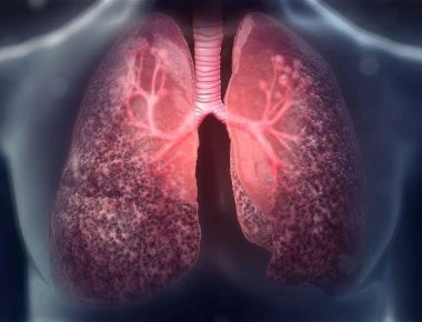 Κυστική ίνωσης: Τι είναι, ποια τα συμπτώματα, πώς γίνεται η διάγνωση;